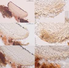 Attēlu rezultāti vaicājumam “Hyphodiscus hymeniophilus”