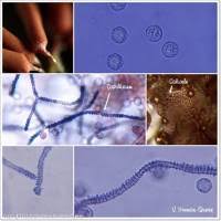 Attēlu rezultāti vaicājumam “Arcyria major”