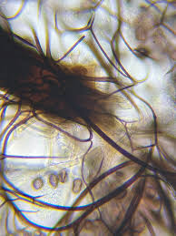 Attēlu rezultāti vaicājumam “Lamproderma elasticum spores”