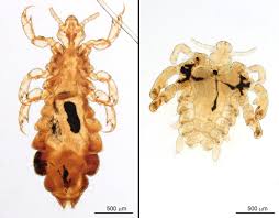 Attēlu rezultāti vaicājumam “Pediculus humanus capitis”