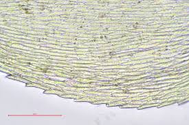 Attēlu rezultāti vaicājumam “Oxyrrhynchium hians var. rigidum macro”