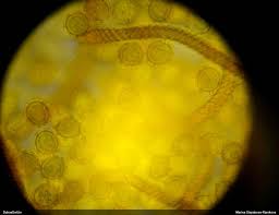 Attēlu rezultāti vaicājumam “Oligonema persimile macro”