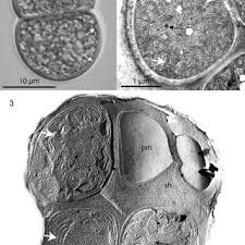 Attēlu rezultāti vaicājumam “Nostoc pruniforme cells”