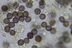 Attēlu rezultāti vaicājumam “Oligonema flavidum spores”