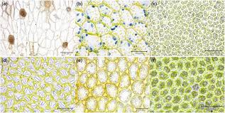 Attēlu rezultāti vaicājumam “Nardia scalaris cells”