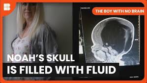 Image result for no brain