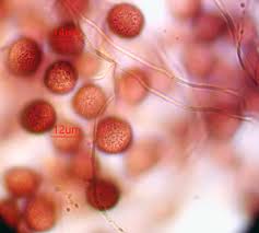 Attēlu rezultāti vaicājumam “Diderma roanense macro”