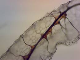 Attēlu rezultāti vaicājumam “Stemonitis splendens spores”