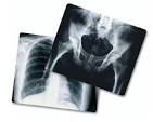 The companies that an <b>x ray</b>