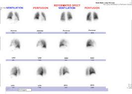 Image result for  v    q