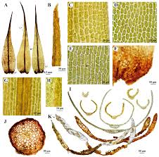 Attēlu rezultāti vaicājumam “Dicranum montanum sporophyte”