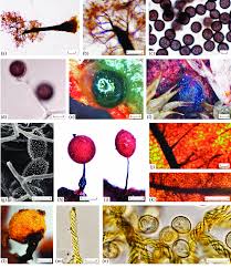 Attēlu rezultāti vaicājumam “Colloderma oculatum spores”