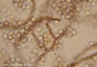 Attēlu rezultāti vaicājumam “Arcyria incarnata”