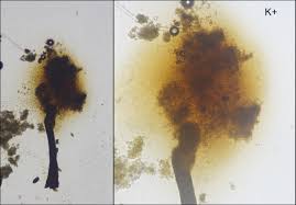 Attēlu rezultāti vaicājumam “Chaenotheca brunneola”