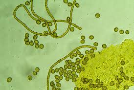 Attēlu rezultāti vaicājumam “Oligonema favogineum spores”
