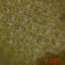 Attēlu rezultāti vaicājumam “Tritomaria exsectiformis”