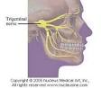 trigeminal <b>neuralgia</b> symptoms