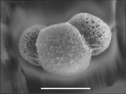 Attēlu rezultāti vaicājumam “pollen corona”