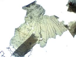 Attēlu rezultāti vaicājumam “Arcyria affinis stalked”