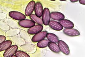 Attēlu rezultāti vaicājumam “Ascobolus furfuraceus”