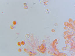 Attēlu rezultāti vaicājumam “Mucronella bresadolae”