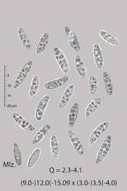 Attēlu rezultāti vaicājumam “Coenogonium pineti”