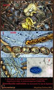 Attēlu rezultāti vaicājumam “Sowerbyella radiculata”
