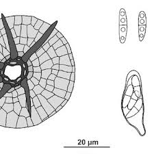 Attēlu rezultāti vaicājumam “Vouauxiomyces santessonii”