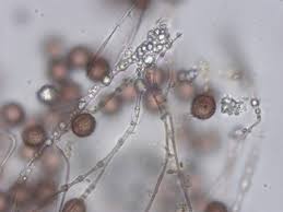 Attēlu rezultāti vaicājumam “Didymium squamulosum”