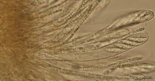 Attēlu rezultāti vaicājumam “Hymenoscyphus calyculus”