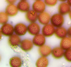 Attēlu rezultāti vaicājumam “Physarum bryomacrocarpum spores”