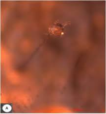 Attēlu rezultāti vaicājumam “Paradiacheopsis sp.”