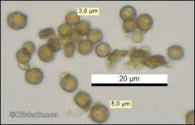 Attēlu rezultāti vaicājumam “Chaenotheca trichialis”