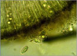 Attēlu rezultāti vaicājumam “Porpidia macrocarpa”