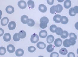 Attēlu rezultāti vaicājumam “Enteridium variabile plasmodium”