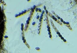 Attēlu rezultāti vaicājumam “Sordaria fimicola”