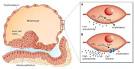 Endocannabinoid Signaling Directs Periimplantation Events