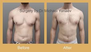 Image result for manboobs