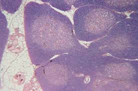 Image result for Thymus