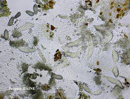 Attēlu rezultāti vaicājumam “Phlyctis agelaea”