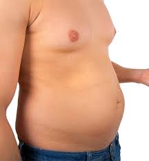 Image result for manboobs