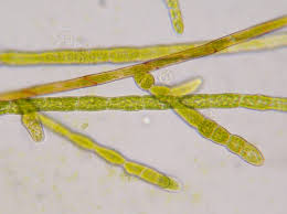 Attēlu rezultāti vaicājumam “Zygodon rupestris”