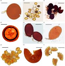 Attēlu rezultāti vaicājumam “Amaurochaete fusiformis spores”