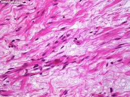Attēlu rezultāti vaicājumam “Barbeyella minutissima”