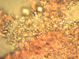 Attēlu rezultāti vaicājumam “Crustoderma dryinum”