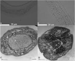 Attēlu rezultāti vaicājumam “Comatricha elegans var. microspora macro”