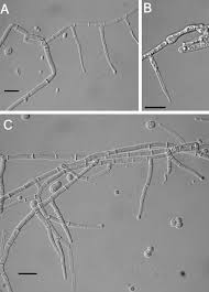 Attēlu rezultāti vaicājumam “Hypocrea pulvinata”