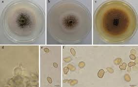 Attēlu rezultāti vaicājumam “Enteridium olivaceum spores”