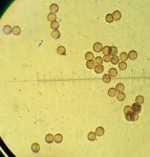 Attēlu rezultāti vaicājumam “Stemonitis splendens spores”