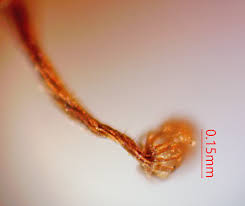 Attēlu rezultāti vaicājumam “Cribraria costata spores”